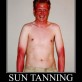 Sun Tanning Fail
