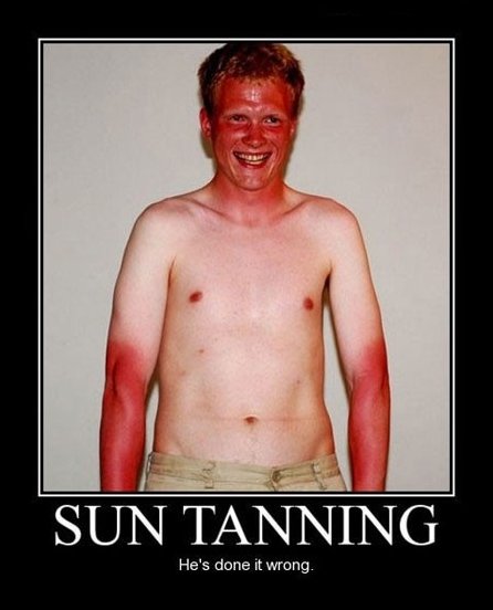 Sun Tanning Fail.