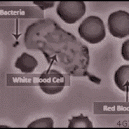 Bacteria vs. White Blood Cell