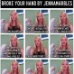 Ways to tell how you broke your hand